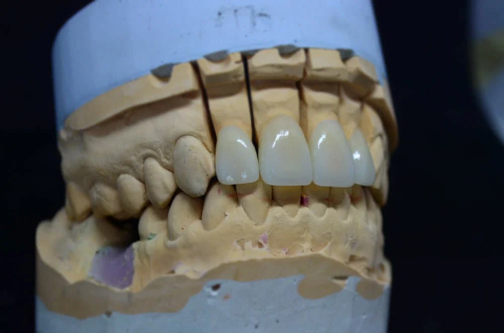 Сравнение с другими коронками Сравнение с другими коронками