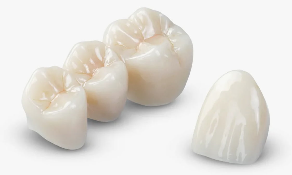 Циркониевые коронки — как выгледят Циркониевые коронки — как выгледят