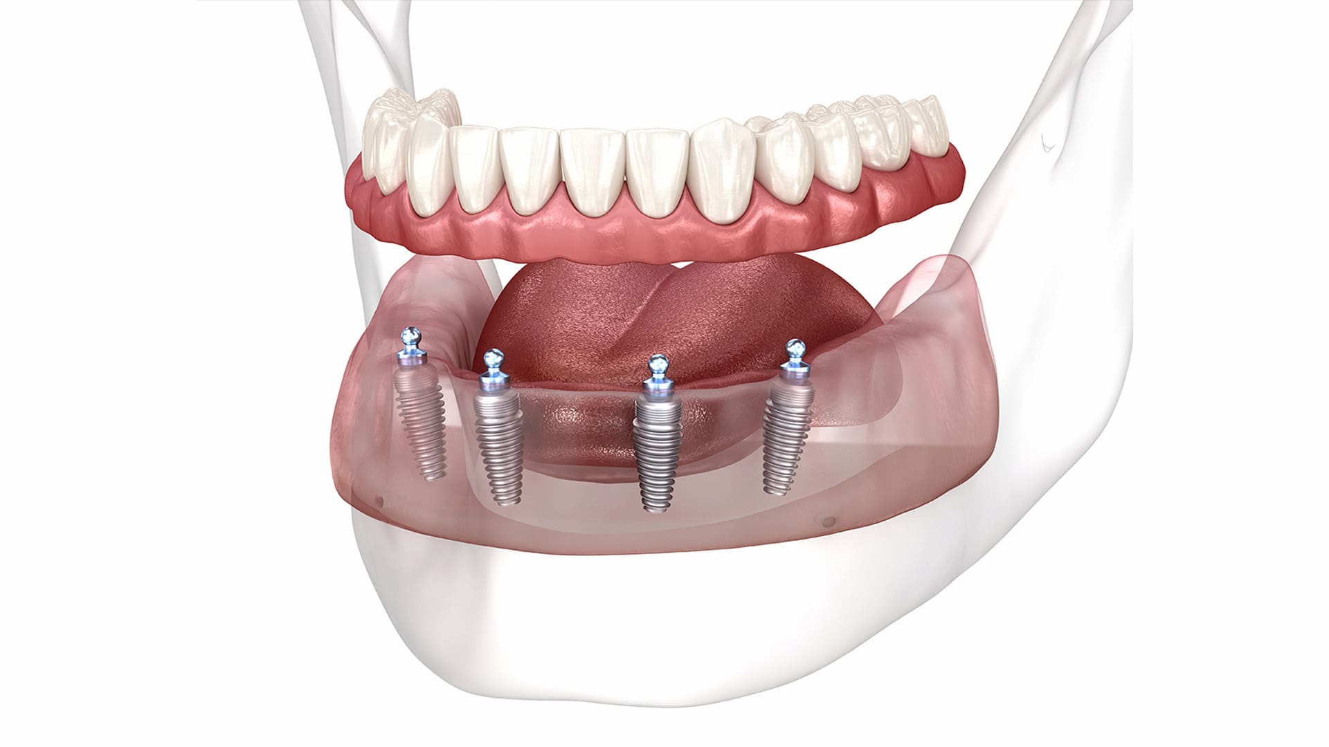 ”Возможные ”Возможные