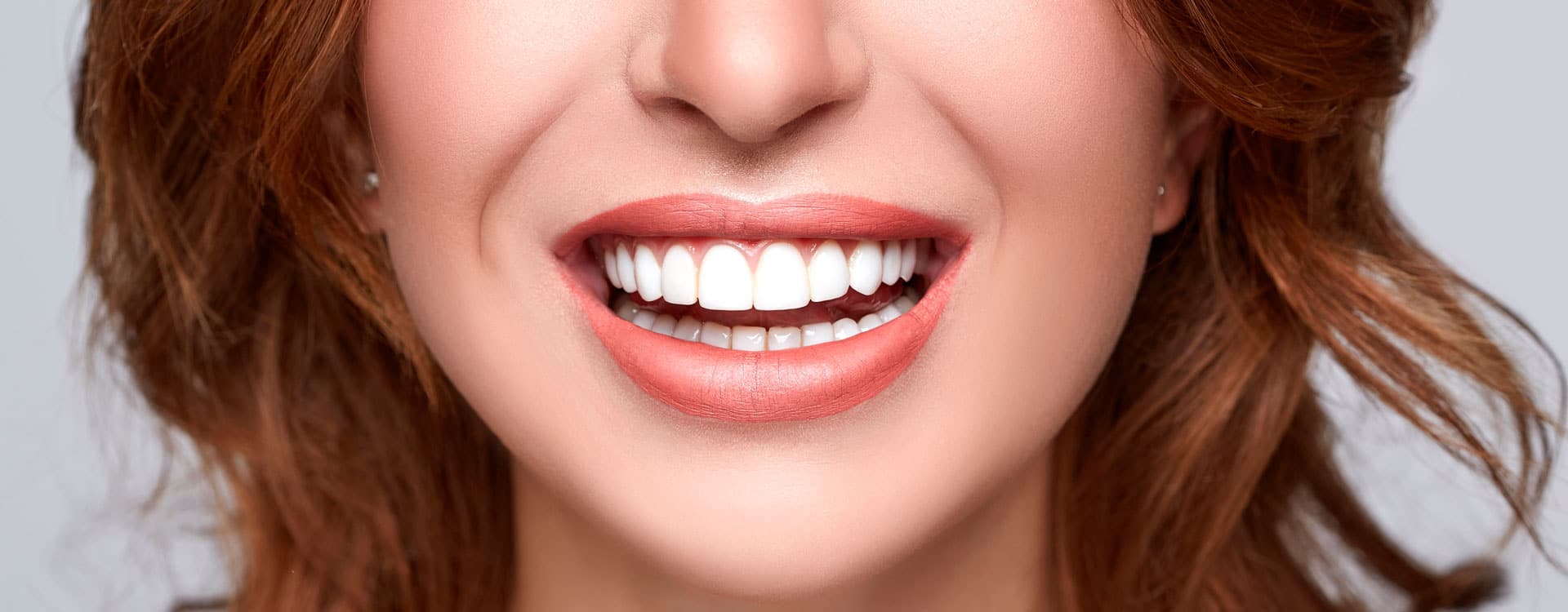 Голливудская улыбка