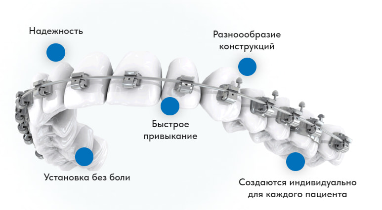 брекеты из керамики брекеты из керамики