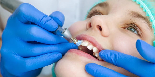 Подготовка поверхности зубов Подготовка поверхности зубов