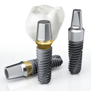 dentium-implantium dentium-implantium