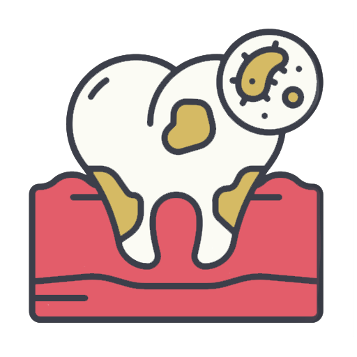 Лечение кариеса (1 зуб)