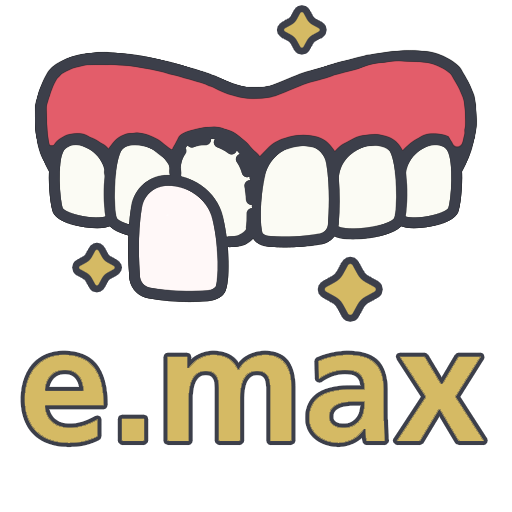 Винир e.max Винир e.max