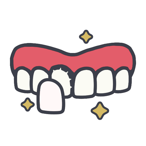 Композитный винир Композитный винир