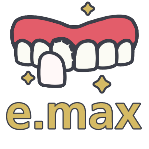 Винир e.max Винир e.max