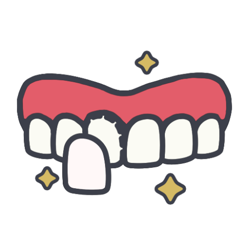 Композитный винир