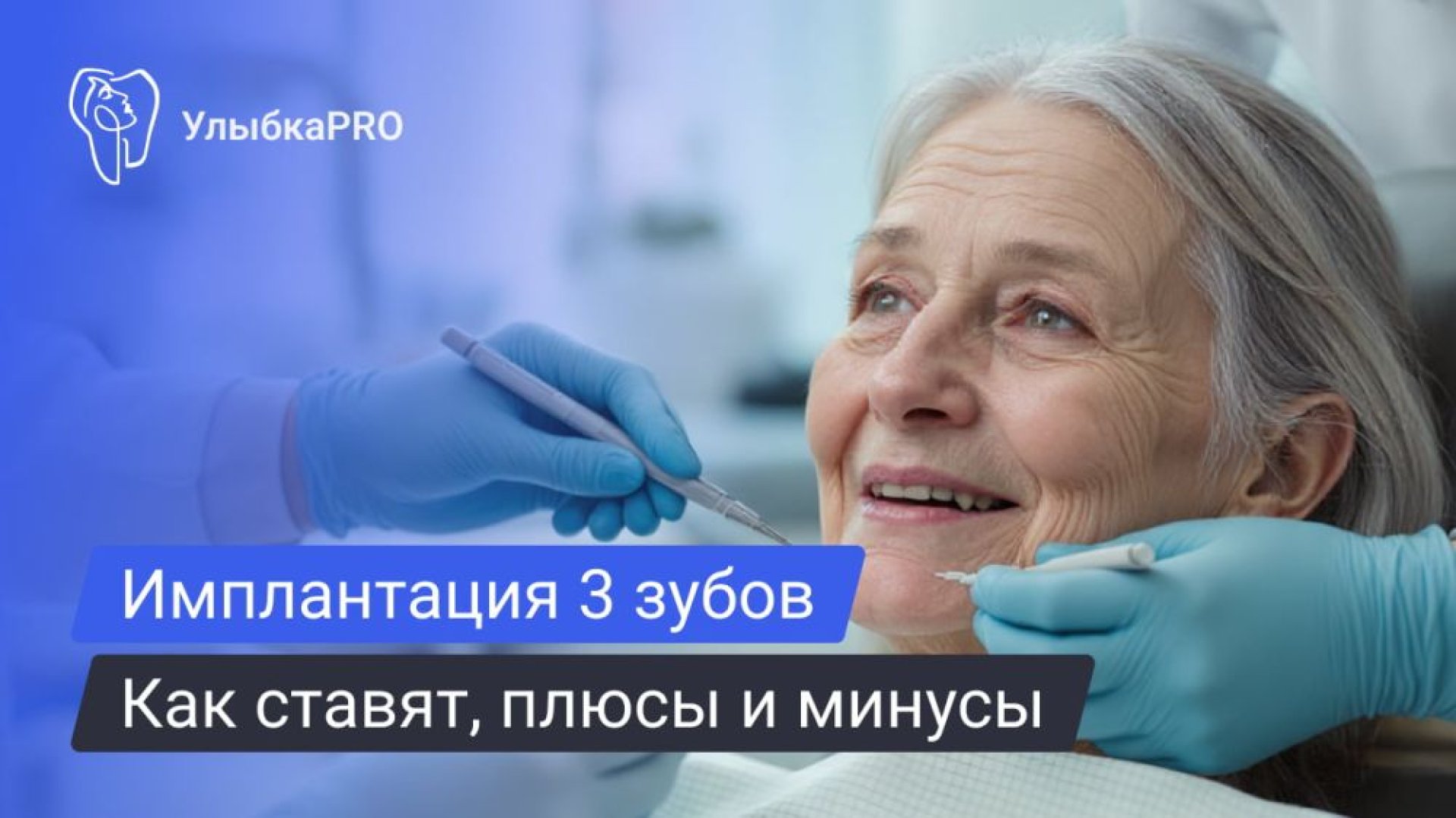 Имплантация трёх зубов