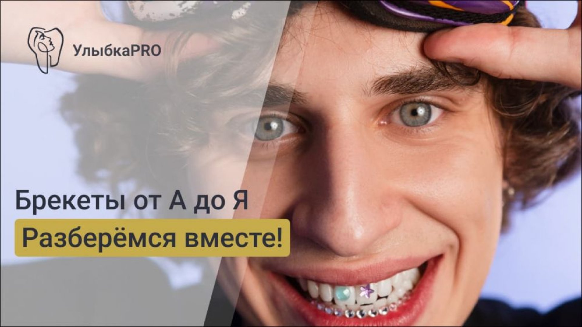 Виды брекетов полный гид