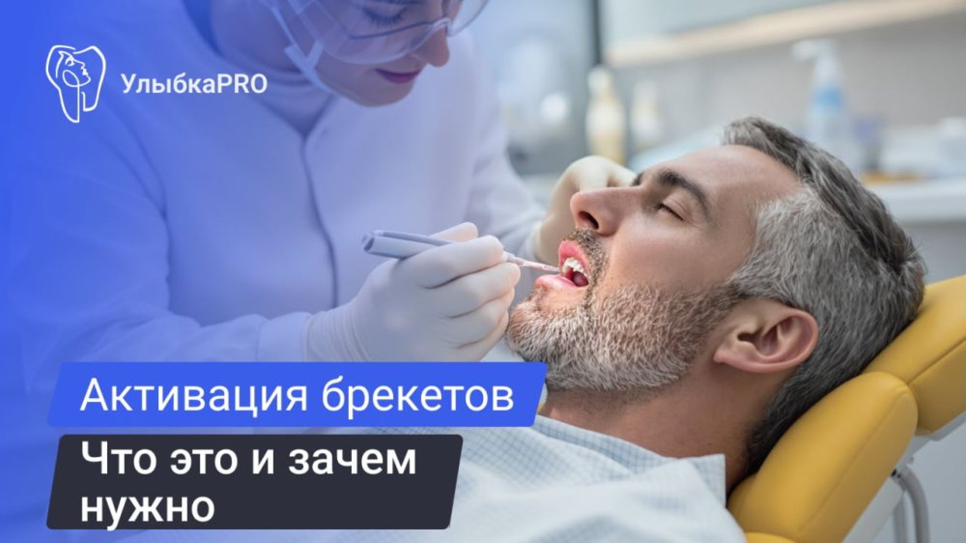 Активация брекетов