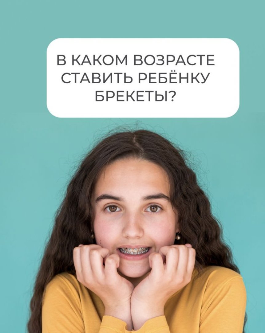 В каком возрасте ставить брекеты ребенку