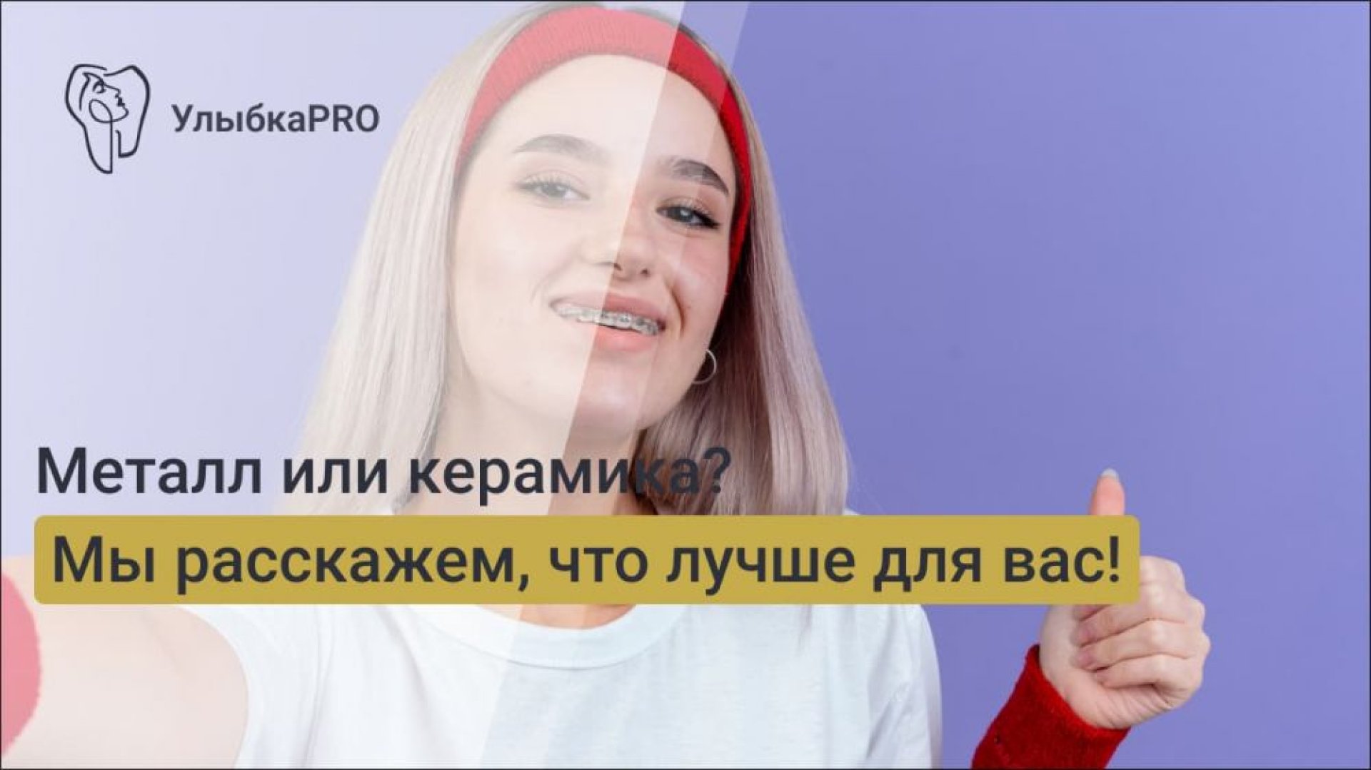 Керамические и металлические брекеты отличия