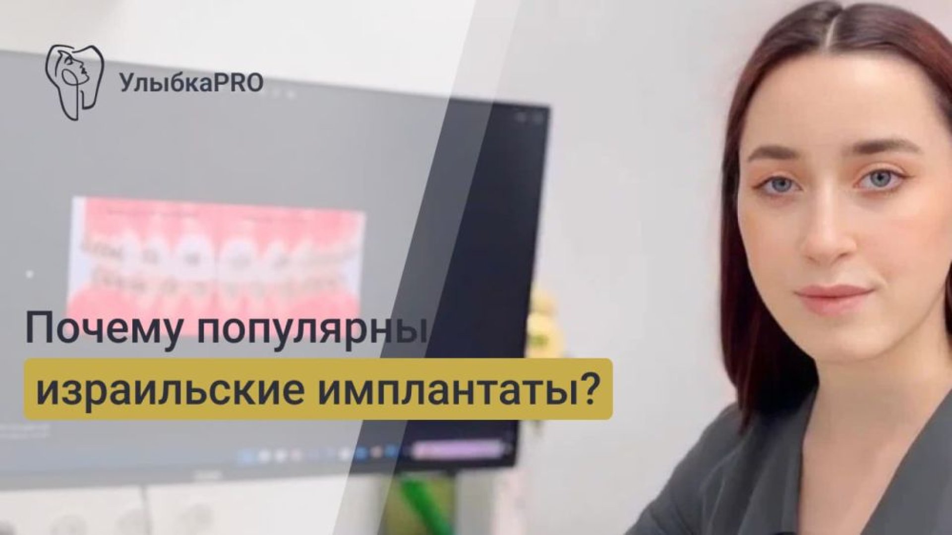 Почему популярны израильские имплантаты