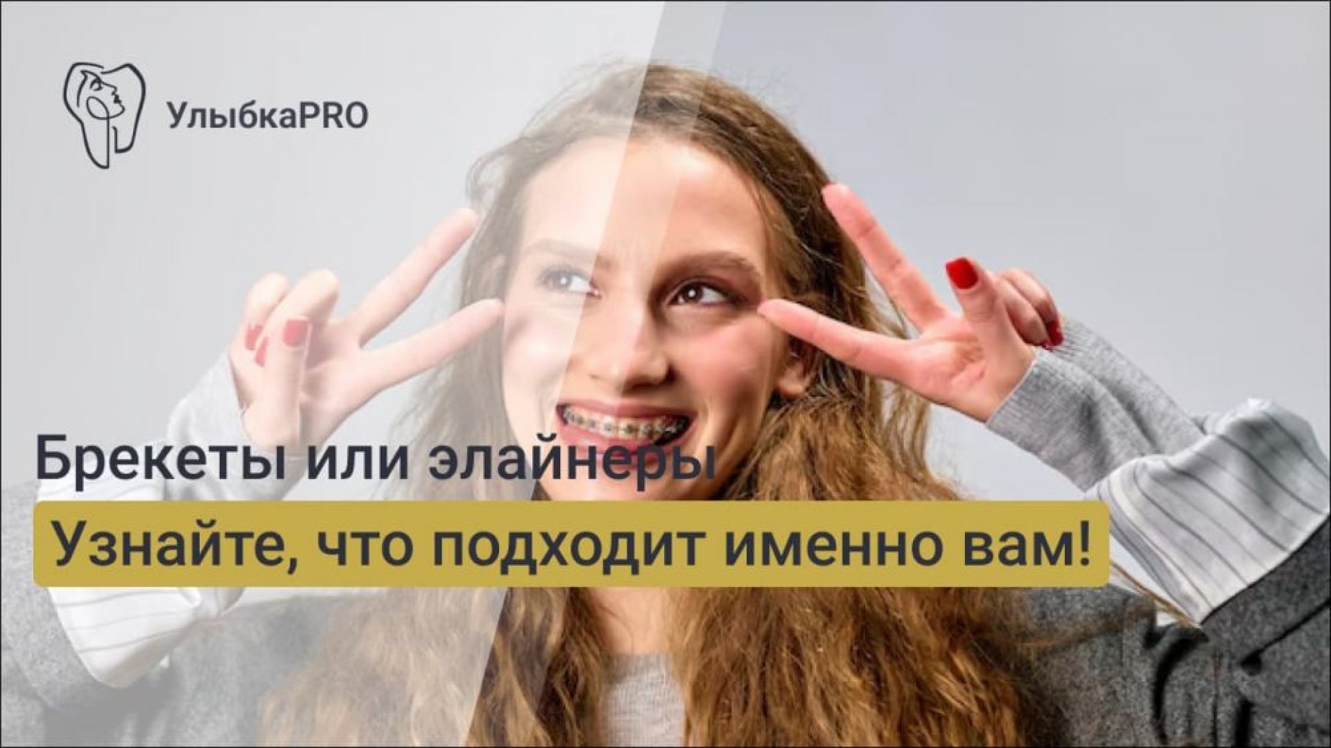 А вы знали Как правильно выбрать между брекетами и элайнерами