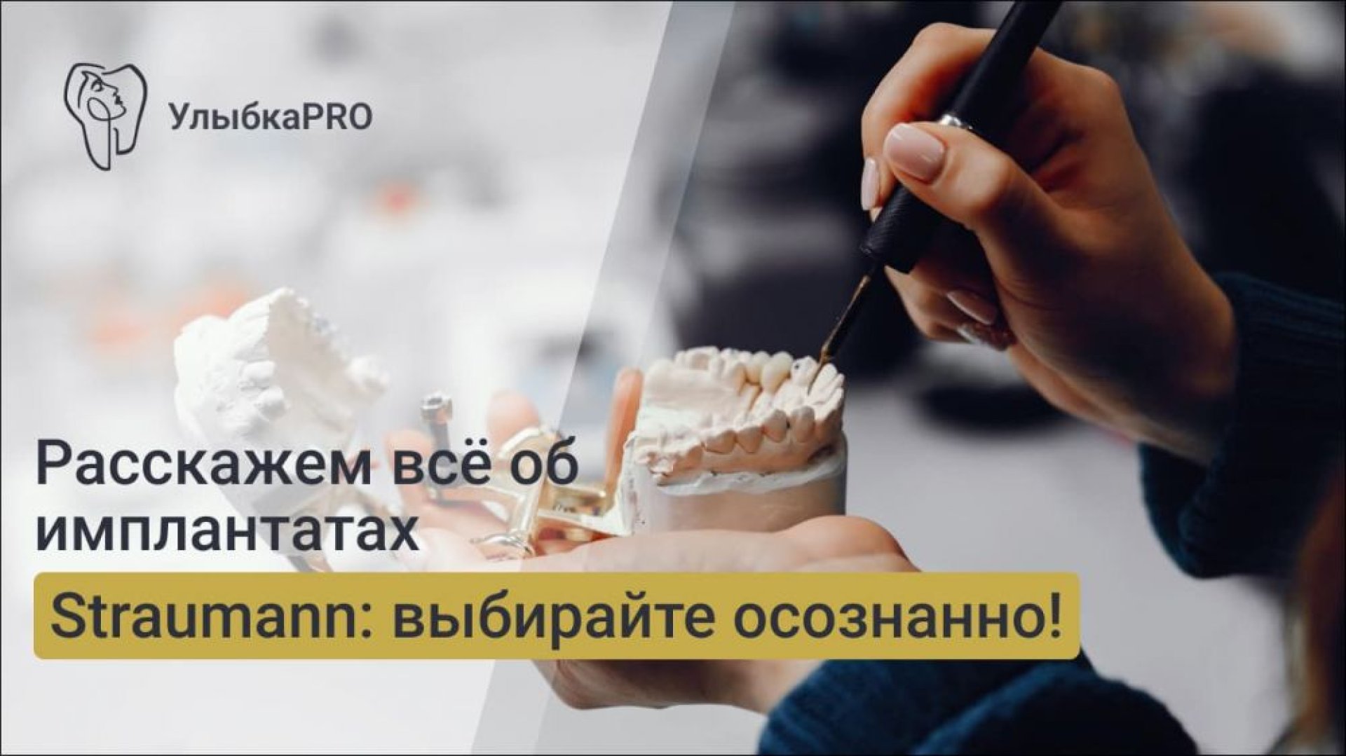 Имплантаты Straumann обзор линеек и их ключевые особенности