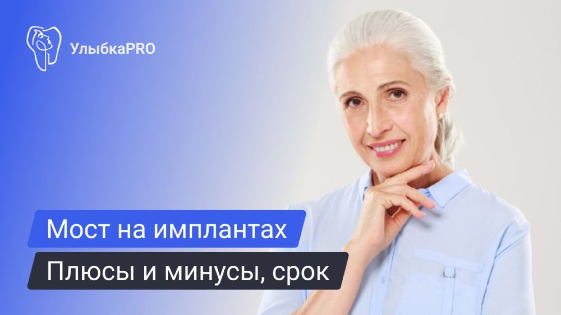 Мост на 2 имплантах на 4 зуба