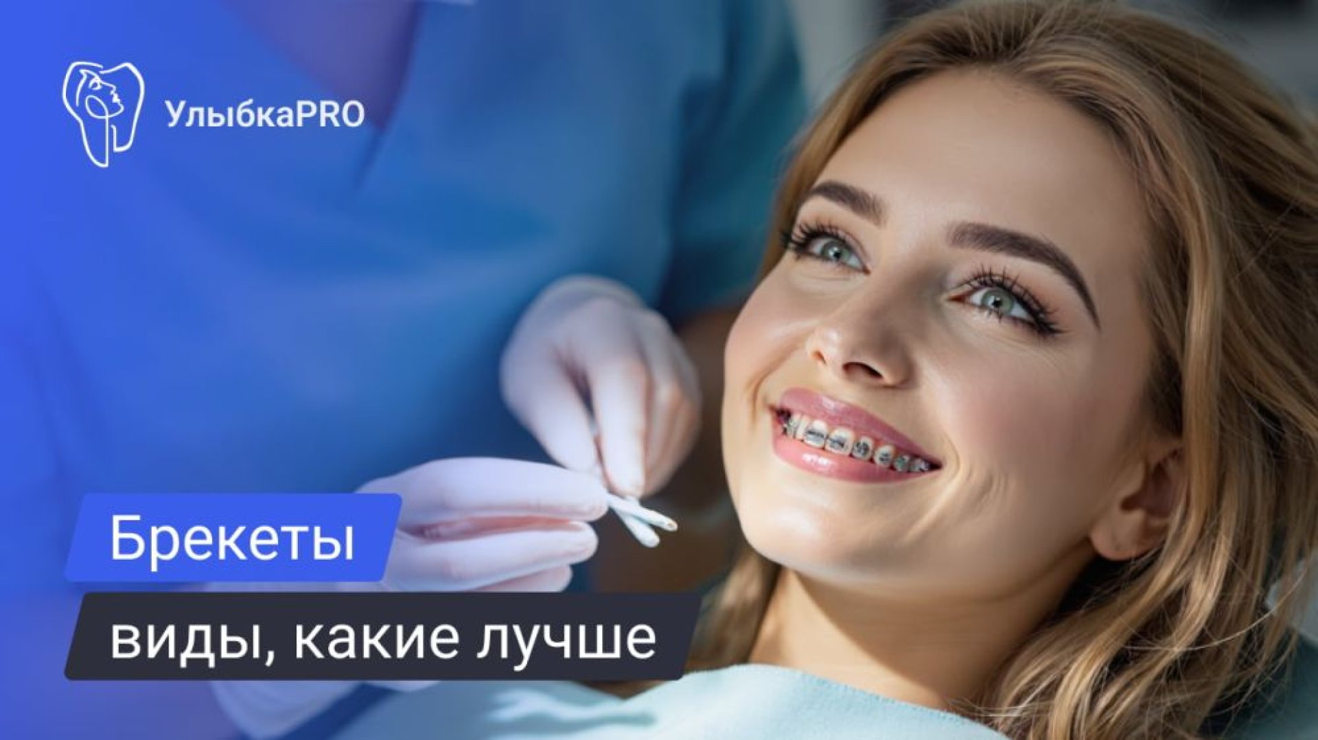 Брекеты виды, отличия и советы по выбору от ортодонта