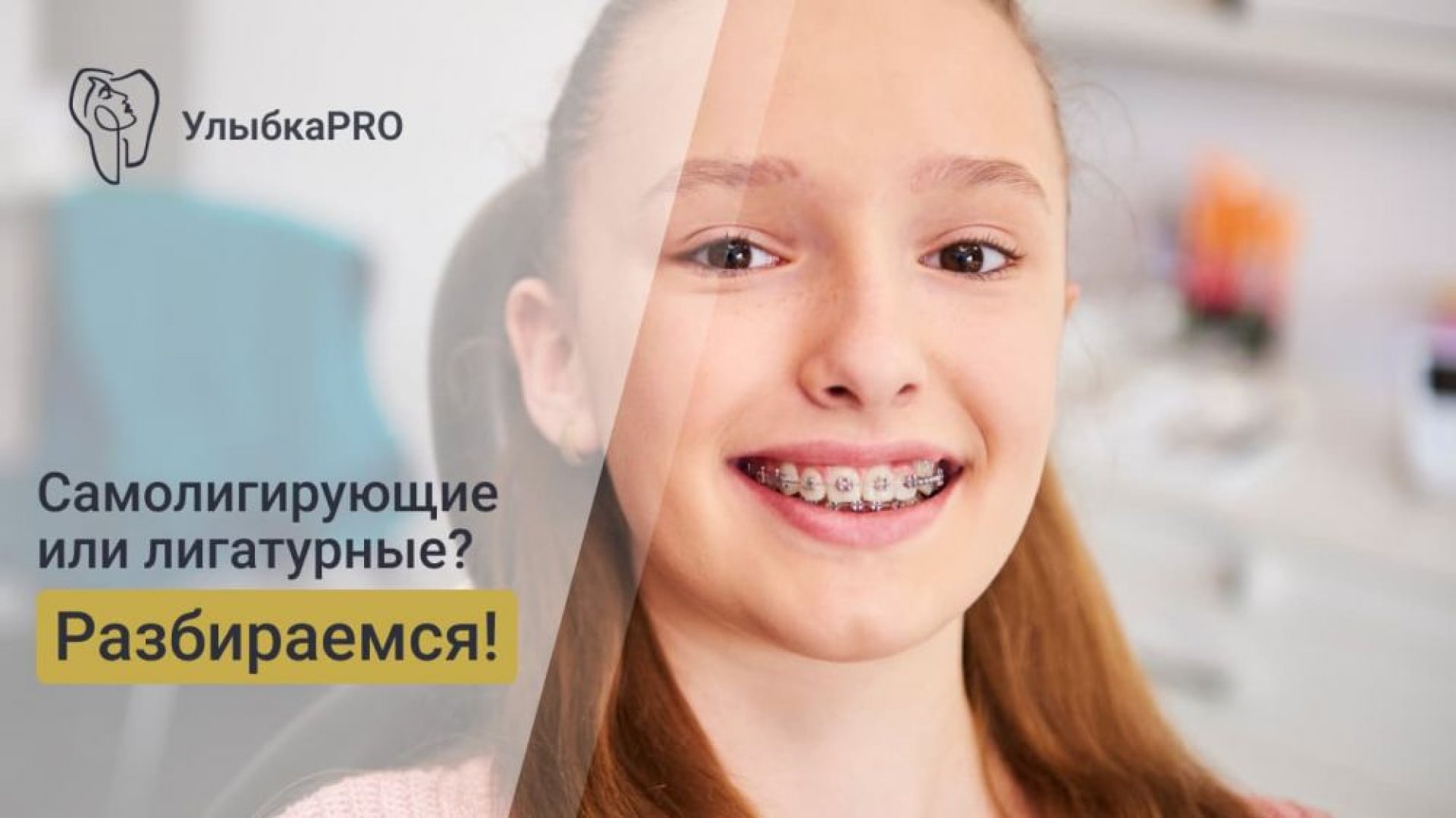 Самолигирующие и лигатурные брекеты что выбратьjpg