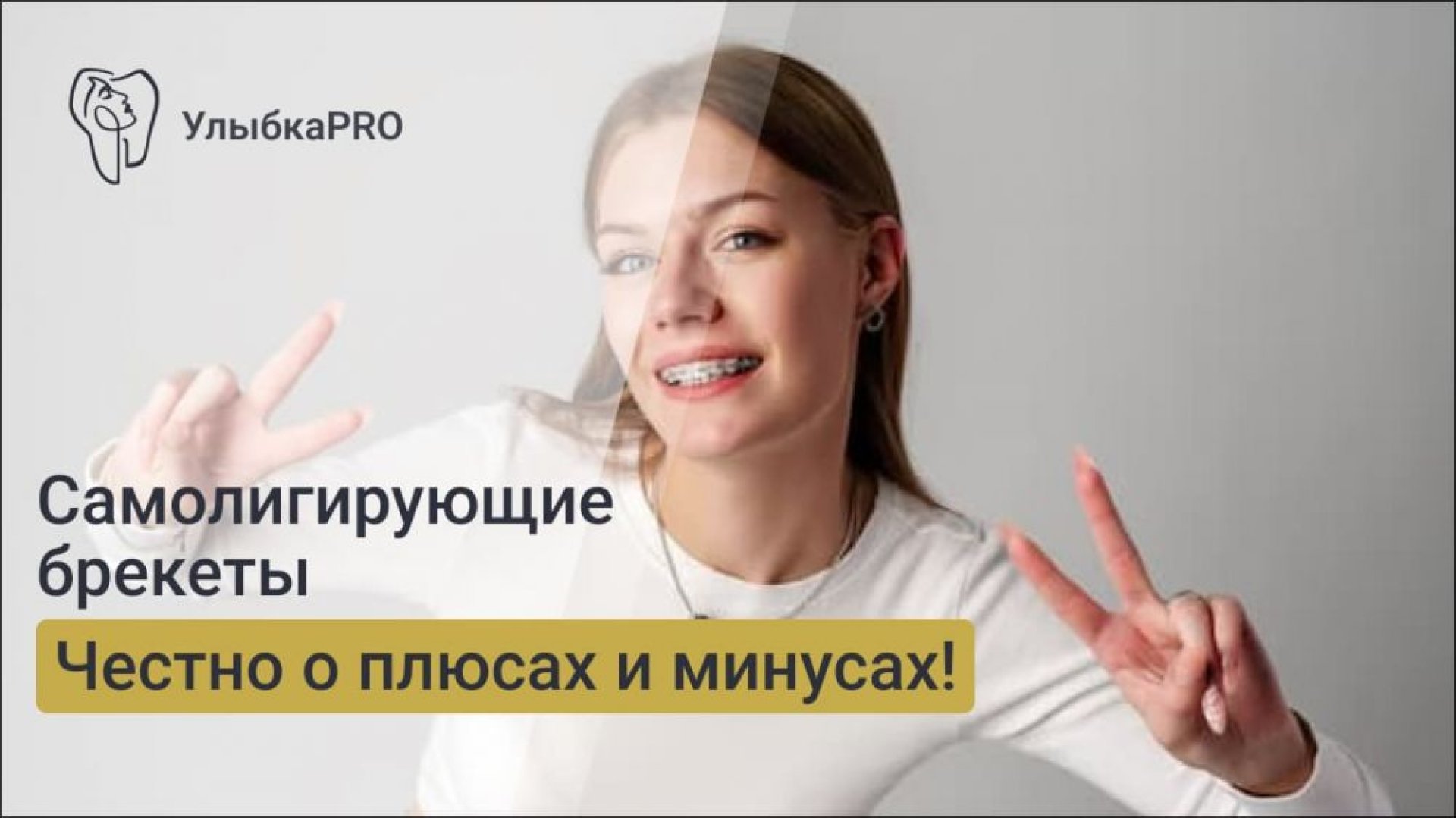 Самолигирующие брекеты плюсы и минусы