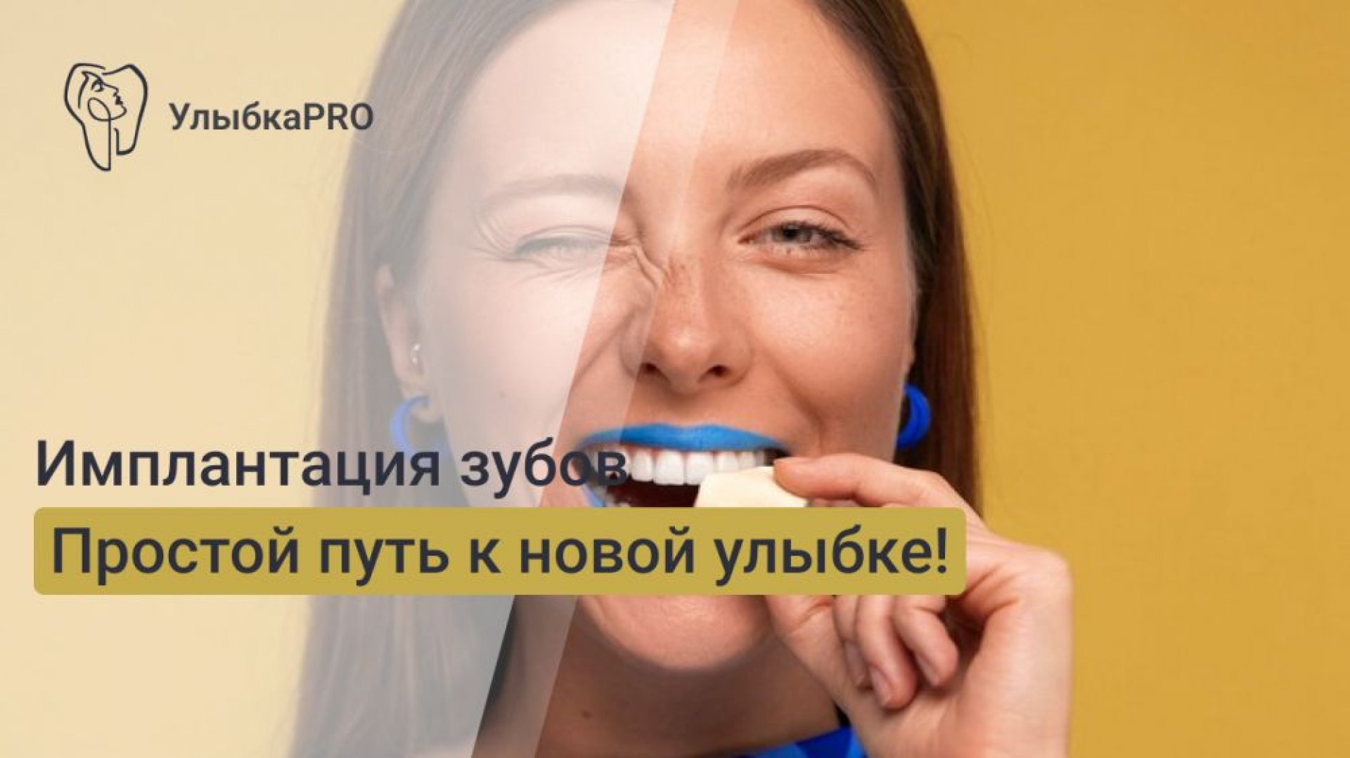 Что такое имплантация зубов и как она проводится