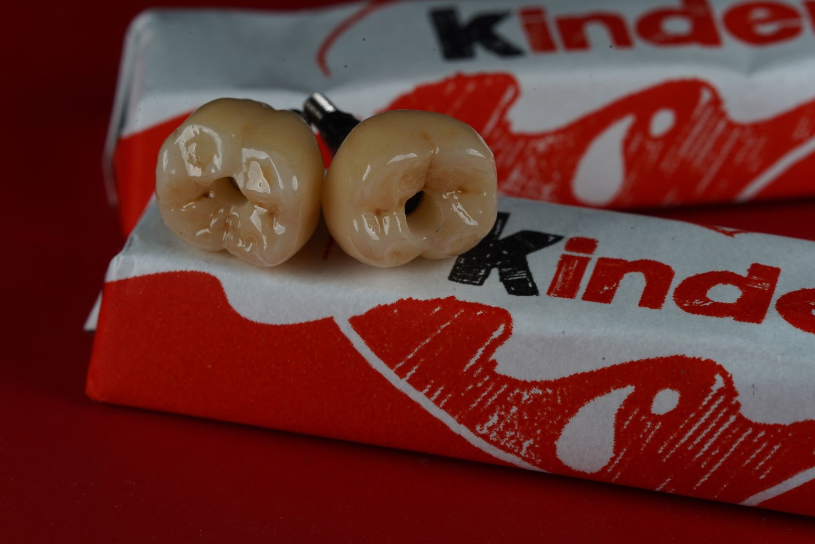 Циркониевая коронка — вид 1