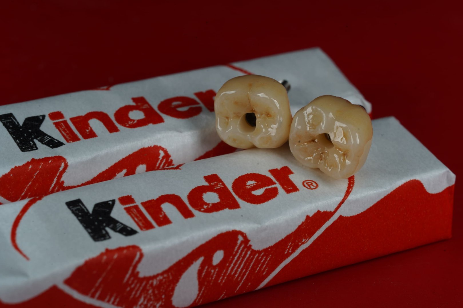 Циркониевая коронка — вид 5