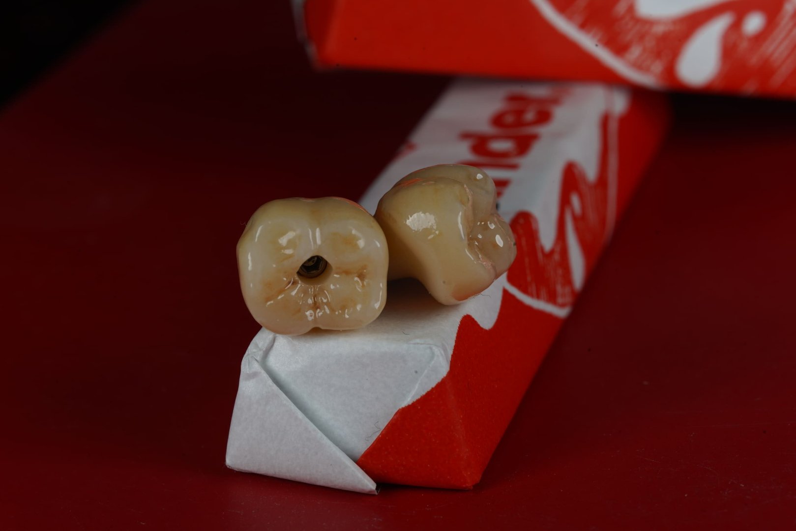 Циркониевая коронка — вид 6