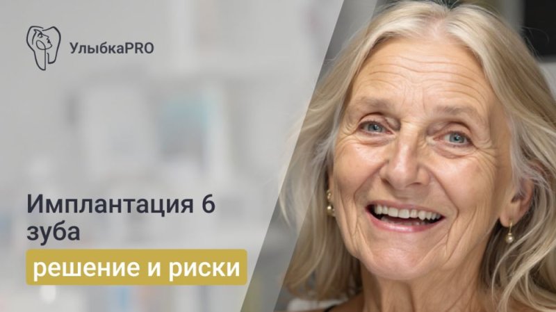 Имплантация 6 зуба
