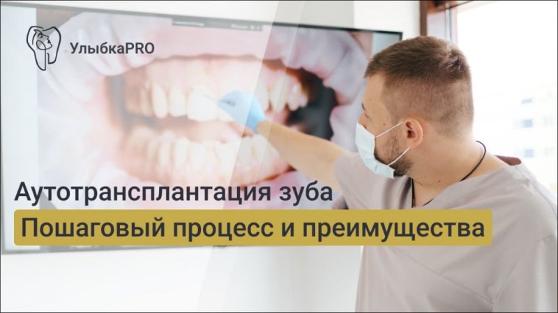 Аутотрансплантация зуба: пошаговый процесс и преимущества