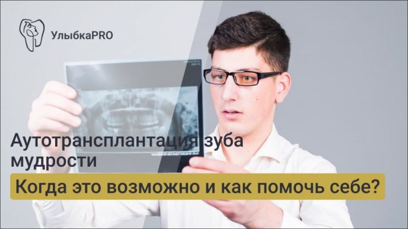 Аутотрансплантация зуба мудрости на место удаленного: в каких случаях это возможно