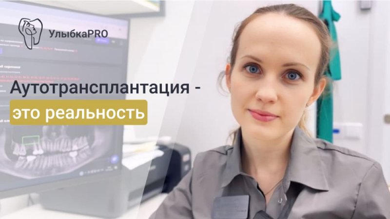 Аутотрансплантация зубов: что это и как работает?