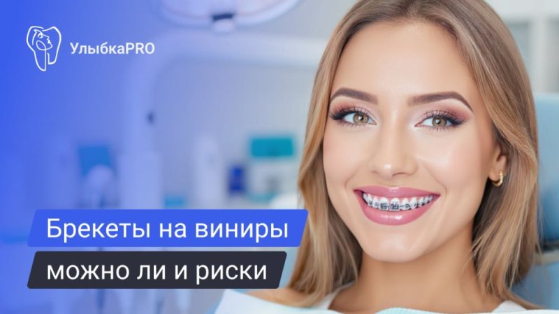 Брекеты после виниров – возможно ли это?