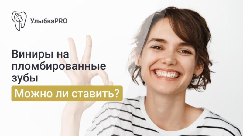 Виниры на пломбированные зубы