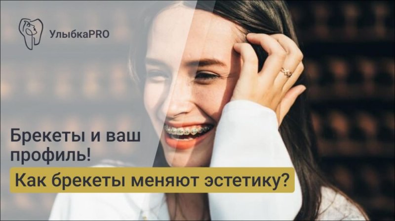 Как брекеты могут изменить ваш профиль: эстетика и физиология в ортодонтии