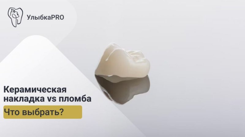 Керамическая накладка vs. пломба: что выбрать?