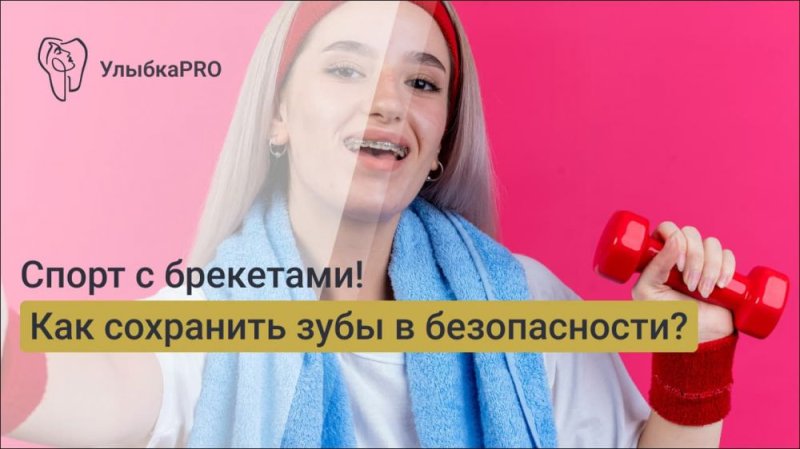 Брекеты и спорт: как не потерять форму и защитить зубы
