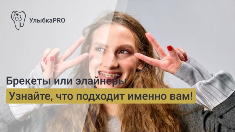 А вы знали? Как правильно выбрать между брекетами и элайнерами?