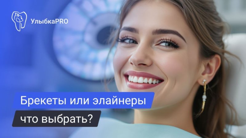 Исправление прикуса – брекеты или элайнеры?