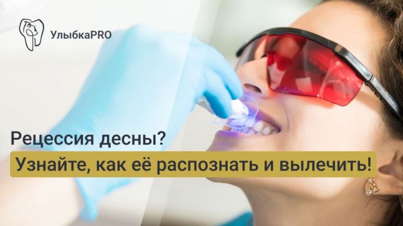 Рецессия десны: как диагностируется заболевание
