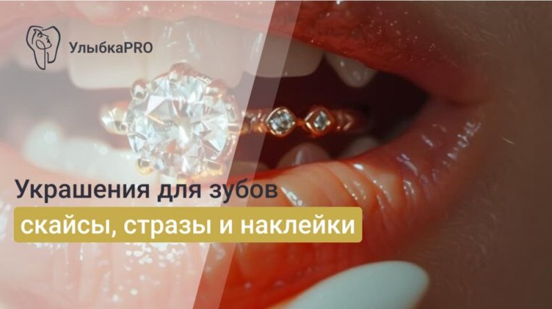 Эстетические украшения зубов: технологии и материалы для установки скайсов, страз и наклеек