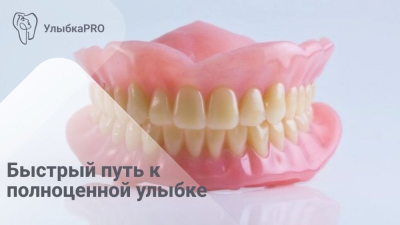 Что такое иммедиат протез и в чем его преимущества?