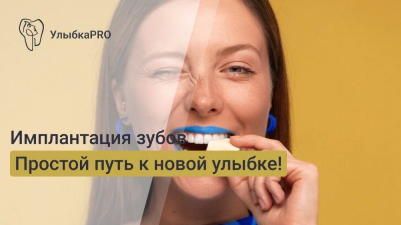Что такое имплантация зубов и как она проводится?