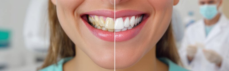 Профессиональная гигиена (чистка зубов)