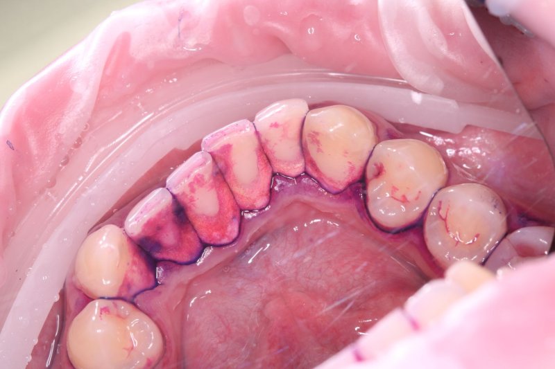 professionalnaya-gigiena-gbt-protokol-rabota-1