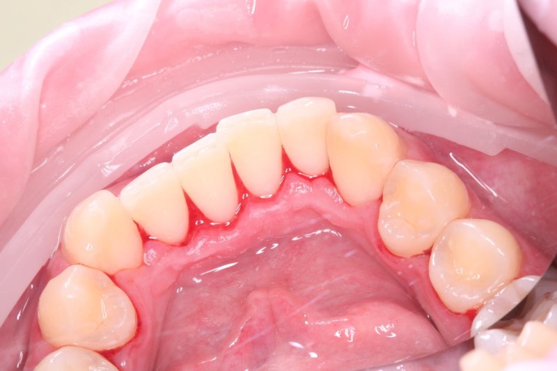 professionalnaya-gigiena-gbt-protokol-rabota-2