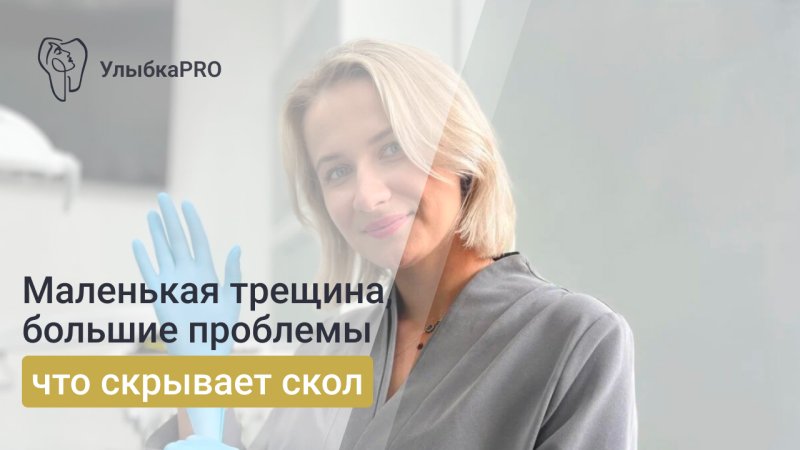 Что делать, если откололся зуб: первая помощь и восстановление