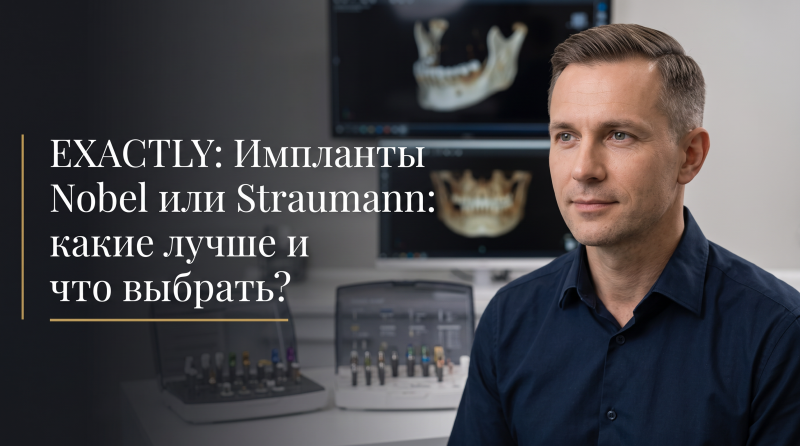 Импланты Nobel или Straumann: какие лучше и что выбрать?
