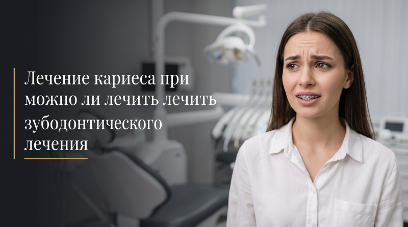 Лечение кариеса при брекетах: можно ли лечить зубы во время ортодонтического лечения