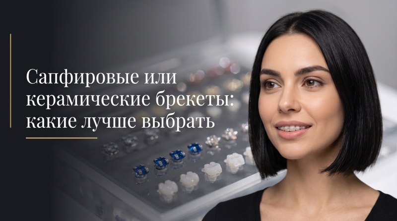 Сапфировые или керамические брекеты: какие лучше выбрать
